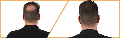 Resultados Antes y Después